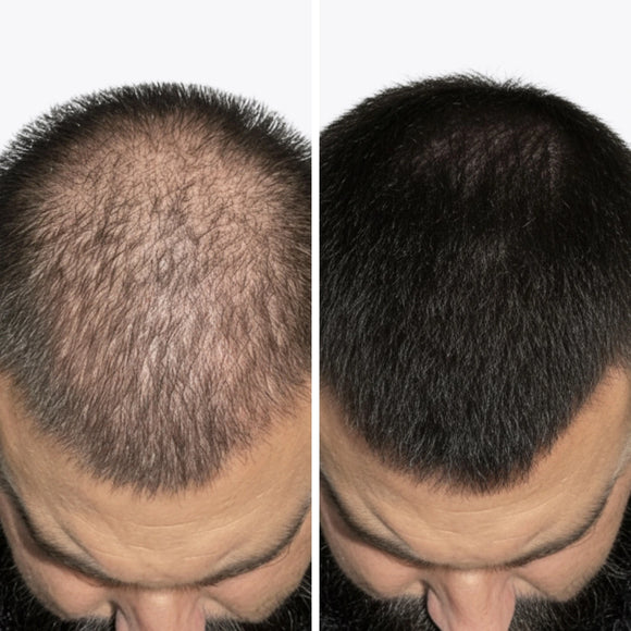 Feature product image